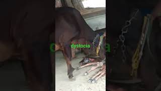 dystocia असामान्य या कठिन प्रसव drjadoun sahab [upl. by Derdlim337]