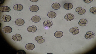 Mitose comment identifier les differents stades de division cellulaire sous le microscope [upl. by Normi745]