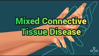 Mixed Connective Tissue Disease  CRASH Medical Review Series [upl. by Akenihs685]