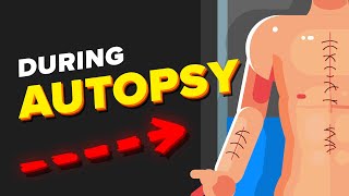 What Actually Happens During an Autopsy [upl. by Alyt]