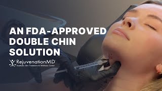 Ditch the Double Chin with Kybella [upl. by Adil]