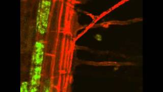 Arbuscular Mycorrhizal Symbiosis Live Imaging [upl. by Eledoya]