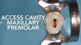 Pre Clinical Endodontic  Access Cavity of Maxillary Premolar [upl. by Carny]