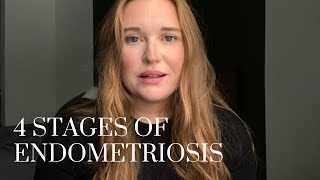 ENDOMETRIOSIS STAGES Understanding the Different Stages of Endometriosis [upl. by Suzetta625]