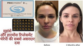 PROGYNOVAEstradiol2mg Tabletमुंहासे और हारमोंस रिप्लेसमेंट थेरेपी की सबसे असरदार दवा Full Review [upl. by Asyle324]