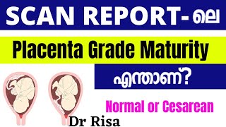 Placenta Grade in Scan Report Malayalam  Placenta Position [upl. by Chas]