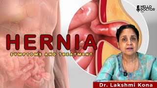 Hernia Symptoms and Treatment  Dr Lakshmi Kona  Hello Doctor Talks [upl. by Marelda]