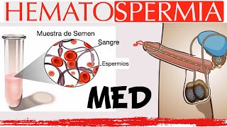 Hematospermia en menos de 2 minutos [upl. by Esyahc]