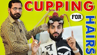 Cupping for Hair Loss  Hijama for Hair Fall  Cupping Therapy for Hair Care  Hair Regrowth Cupping [upl. by Cerys]