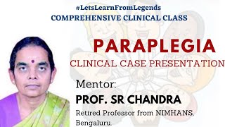 Paraplegia  Potts spine Clinical case presentation [upl. by Oinimreh]