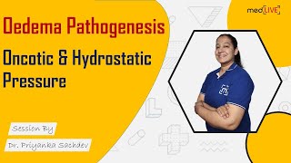 Oedema Pathogenesis  Oncotic amp Hydrostatic Pressure  Pathology  MedLive by Dr Priyanka Sachdev [upl. by Ttenrag683]