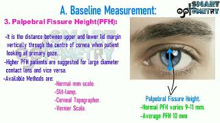 Pupil size and VVID in Contact Lens Practice [upl. by Aseuqram]