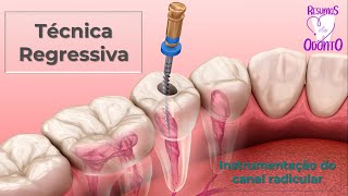 Técnica Regressiva  Instrumentação do conduto radicular  Canal Resumos de Odonto [upl. by Nauqyt]