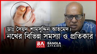 নখের বিভিন্ন সমস্যা ও প্রতিকার  Bangla Affairs  Ingrown Nail Treatment [upl. by Yelsna]