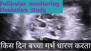 Follicular monitoring Ovulation study FollicleDoctor home [upl. by Bluefarb]