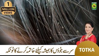 Zubaida Apa Totkay  Sar Ki Juen Khatam Karne Ka Tarika  Head Lice Removal  MasalaTv [upl. by Nomannic]