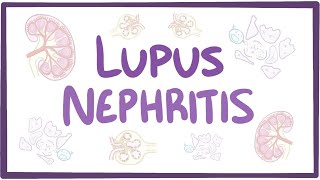 Lupus nephritis  causes symptoms diagnosis treatment pathology [upl. by Jc]