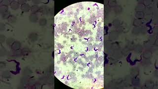 Trypanosoma under microscope microscopic parasitology Trypanosomiasis [upl. by Gerius]