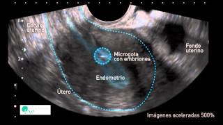 INSTITUT MARQUÈS  El útero mueve a los embriones para que se implanten correctamente [upl. by Mehalick]