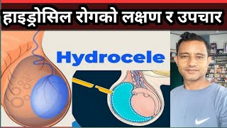 Hydrocele details in Nepali हाइड्रोसिल कसरी हुन्छ यसको लक्षण तथा औषधि उपचार कसरी गर्ने [upl. by Cindra]