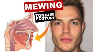 MEWING Tongue Posture  Train Your Tongue to Attach to Your Mouth [upl. by Ardisj66]