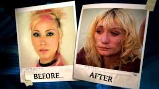 A Sobering Look at What Meth Can Do to Your Appearance [upl. by Bilicki]