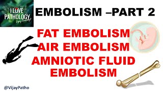 EMBOLISM Part 2 Fat Air amp Amniotic fluid embolism [upl. by Whitver]