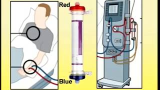 Setting Up of Dialysis Machine [upl. by Assilat167]