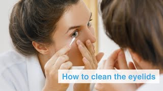 How to clean the eyelids for blepharitis treatment [upl. by Aliuqaj968]