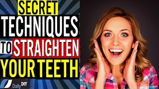 How to Straighten Your Teeth at Home Without Braces Hidden Secret Techniques [upl. by Corson]