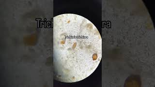 Trichuris trichiura biología science musica [upl. by Negeam800]