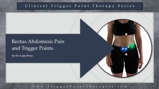 Rectus Abdominis Pain and Trigger Points [upl. by Kammerer]