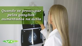 Gânglios na Axila ⚠️ ALERTA ⚠️ Quando deve se PREOCUPAR  Dra Vanderlea Coelho ®️ Câncer de Mama [upl. by Mayhew]