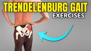 3 Exercises to Correct a Trendelenburg Gait Pattern [upl. by Gaylor]