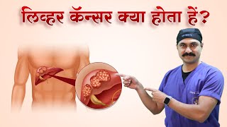 क्या Liver Cancer को ठीक कर सकते है Liver Cancer Treatment  DrBipin Vibhute  Hindi [upl. by Ynohtnacram]