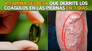 💊🚨 La VITAMINA SECRETA Que Disuelve los Coágulos de Sangre en Tus Piernas 🦵💥 [upl. by Rutan]