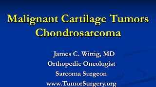 Orthopedic Oncology Course  Malignant Cartilage Tumors Chondrosarcoma  Lecture 6 [upl. by Hickie]