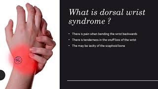 Dorsal Wrist Syndrome  Everything You Wanted to Know [upl. by Ginnifer]