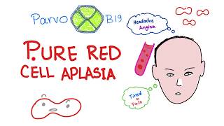 Pure Red Cell Aplasia PRCA  Parvo B19 Virus  Hematology [upl. by Ellimahs]