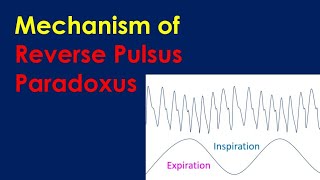 Mechanism of Reverse Pulsus Paradoxus [upl. by Phippen]