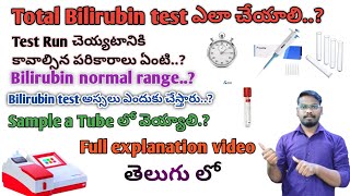 How to Run a Total Bilirubin test In Telugu by Mr vineel [upl. by Vtehsta54]