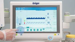 Lowflow anaesthesia for lung protective ventilation with Atlan anaesthesia workstations [upl. by Pearlstein]