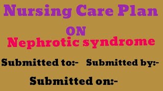 Nursing care plan on Nephrotic syndromepediatrics care plan on Nephrotic syndrome [upl. by Scutt661]