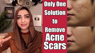 REMOVE FACE SCARS ACNE SPOTS amp PIMPLES MEDICATED GEL REVIEW [upl. by Gabriellia]