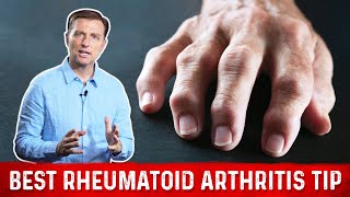 Best Tip For Rheumatoid Arthritis – Joint Pain Relief By DrBerg [upl. by Dace497]