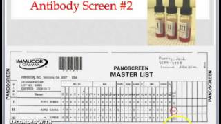 Practical Transfusion Medicine Part 1  Blood Typing Antibody Screen and Crossmatch [upl. by Redfield]