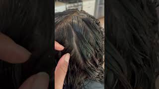 Dandruff l flaky scalp l hair video l treatment [upl. by Plotkin]