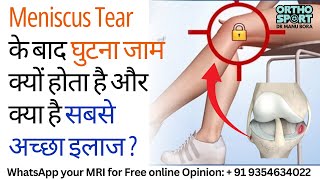 Meniscus Tear के बाद घुटना जाम क्यों होता है और क्या है सबसे अच्छा इलाज [upl. by Georgeta]