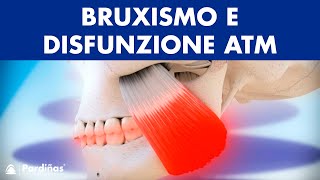 Bruxismo e disfunzione articolazione temporomandibolare © [upl. by Riddle]