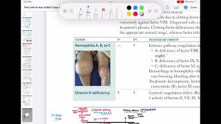 Coagulation disorders haematology 61 First Aid USMLE Step 1 in UrduHindi [upl. by Fretwell]